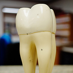 Tooth Model